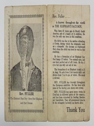 Item #5368 Compliments of Rev. Fuller...Known Throughout the World as the Elephant Face Boy...